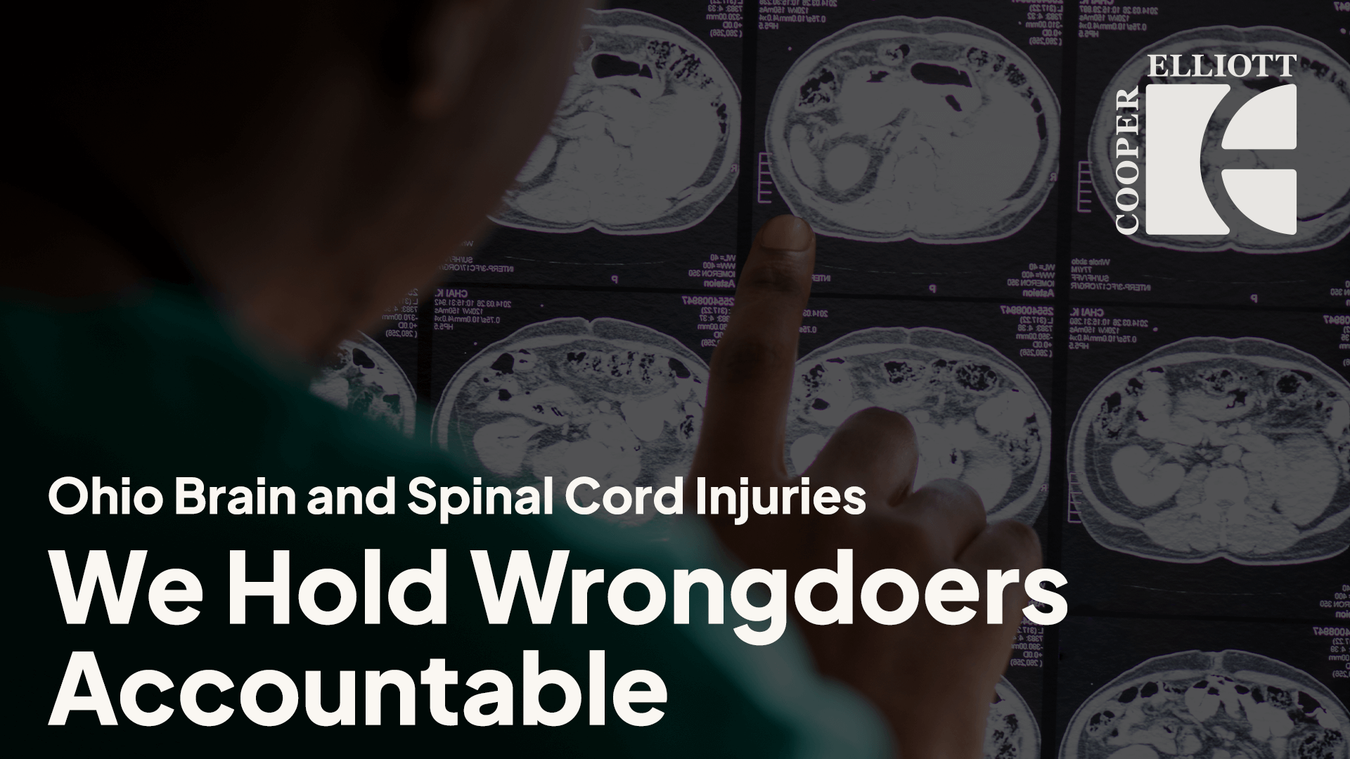 Ohio Brain And Spinal Cord Injury Lawyer Cooper Elliott Law Firm